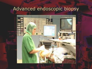 Advanced endoscopic biopsy
 