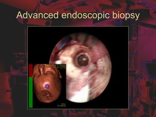 Advanced endoscopic biopsy
 