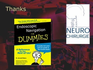 Thanks
Endoscopic
Navigation
 