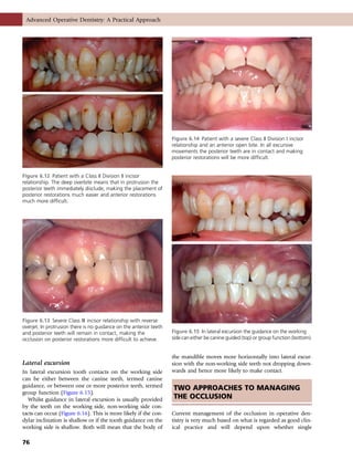 Lateral Excursion Interferences Advanced operative dentistry | PDF