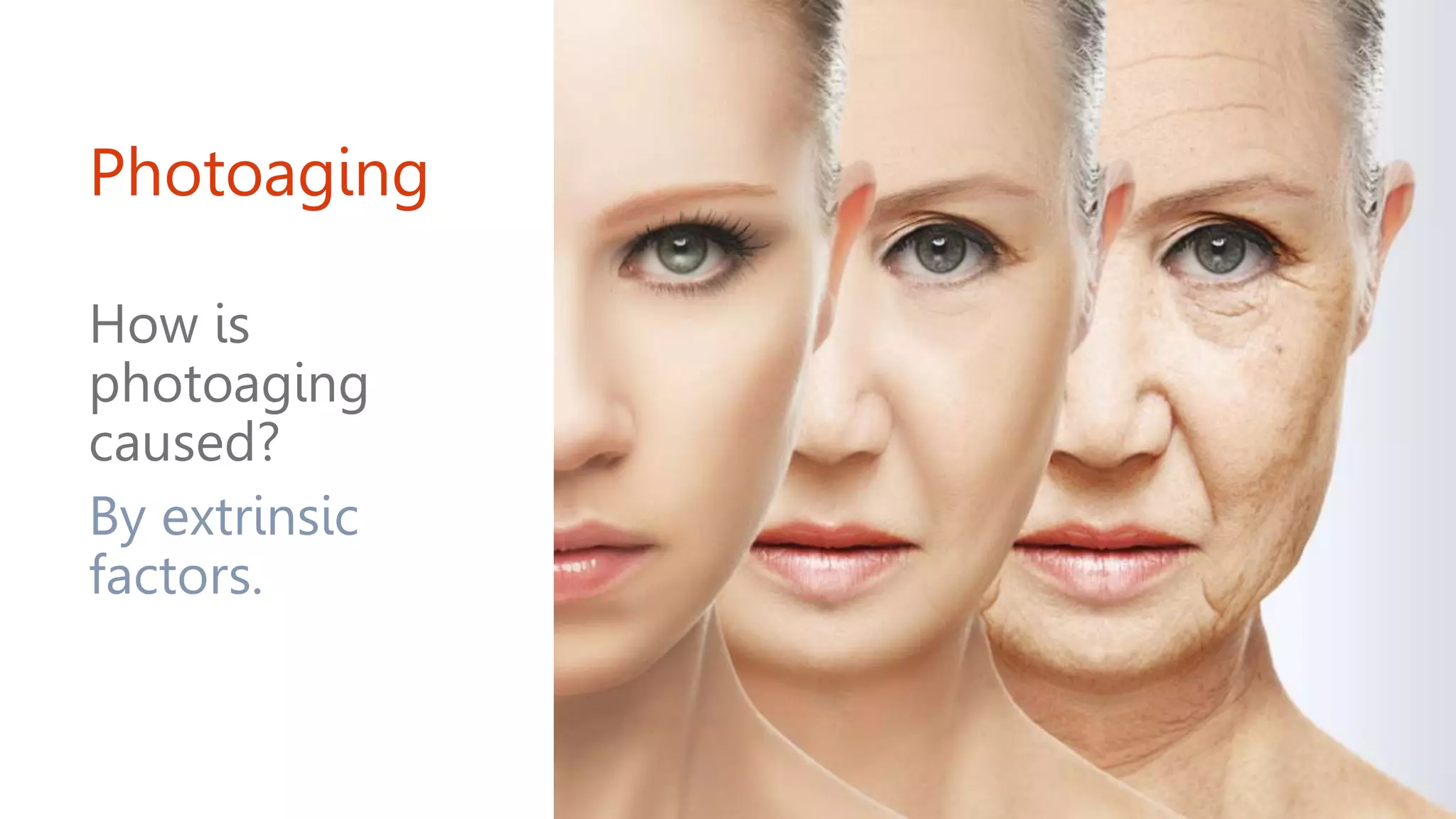 Photoaging
How is
photoaging
caused?
By extrinsic
factors.
 
