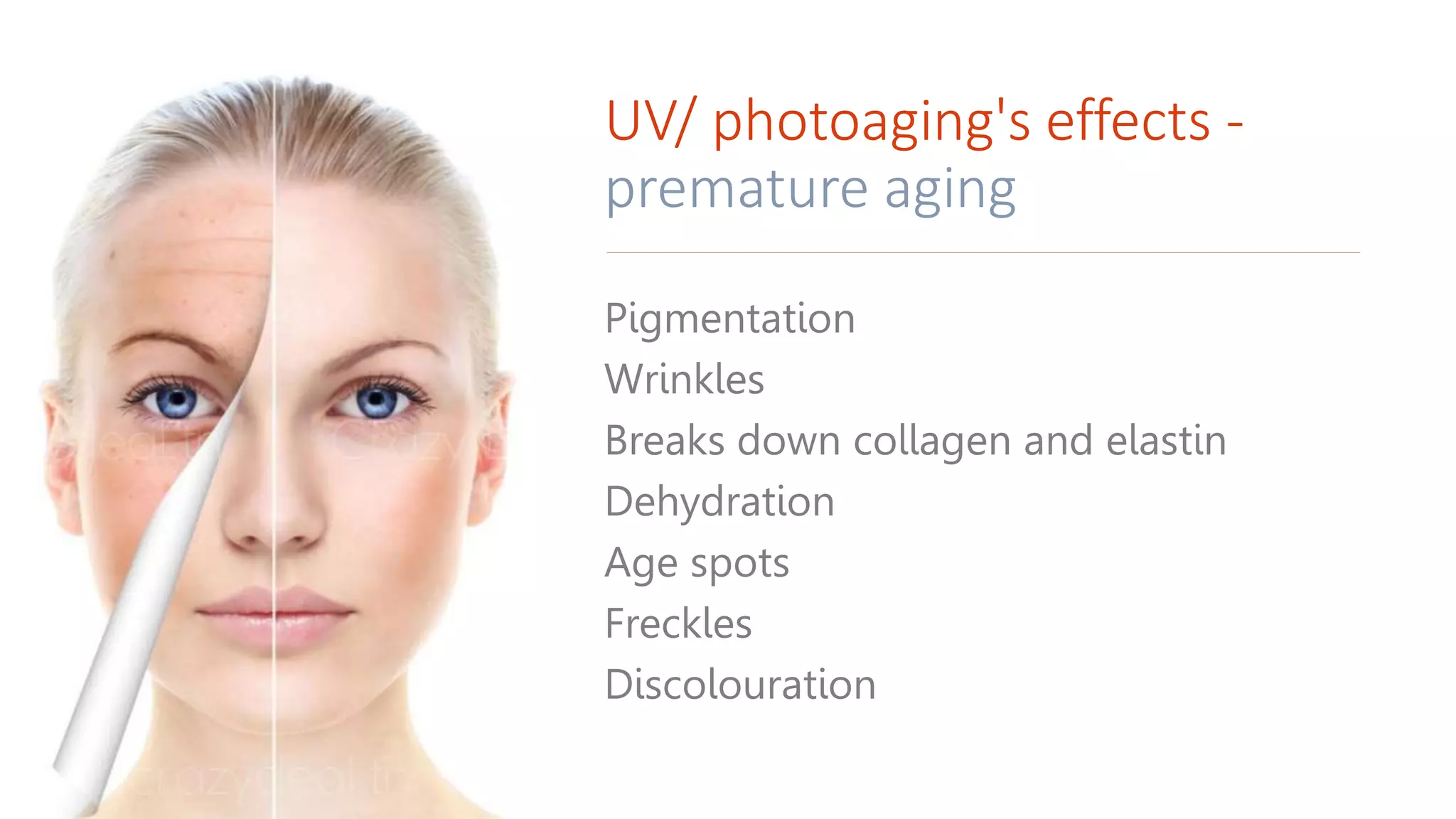 UV/ photoaging's effects -
premature aging
Pigmentation
Wrinkles
Breaks down collagen and elastin
Dehydration
Age spots
Freckles
Discolouration
 