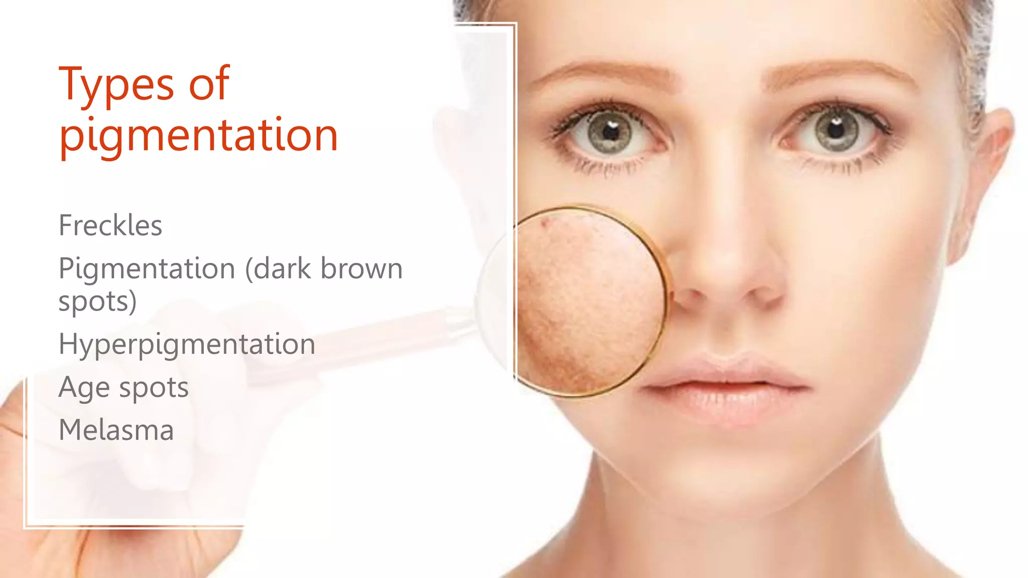 Types of
pigmentation
Freckles
Pigmentation (dark brown
spots)
Hyperpigmentation
Age spots
Melasma
 
