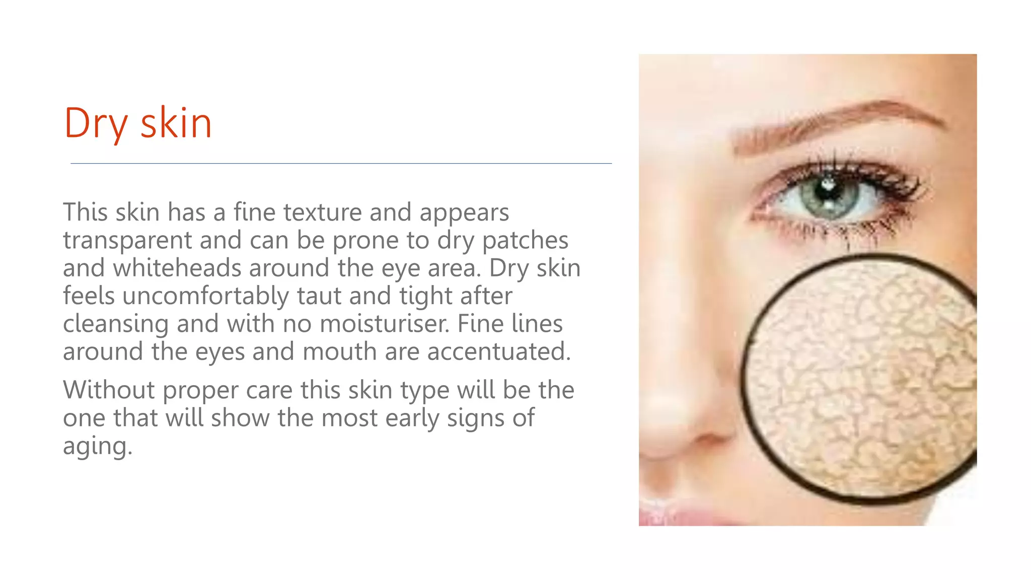 Dry skin
This skin has a fine texture and appears
transparent and can be prone to dry patches
and whiteheads around the eye area. Dry skin
feels uncomfortably taut and tight after
cleansing and with no moisturiser. Fine lines
around the eyes and mouth are accentuated.
Without proper care this skin type will be the
one that will show the most early signs of
aging.
 