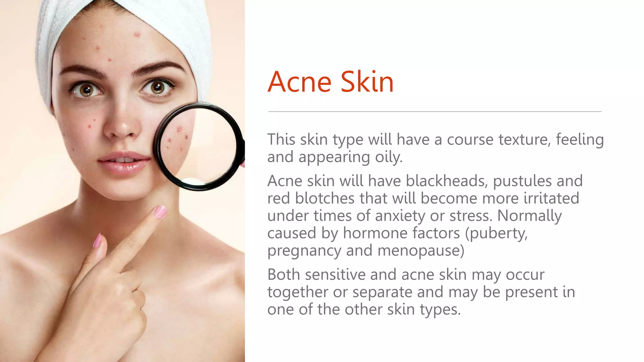 Acne Skin
This skin type will have a course texture, feeling
and appearing oily.
Acne skin will have blackheads, pustules and
red blotches that will become more irritated
under times of anxiety or stress. Normally
caused by hormone factors (puberty,
pregnancy and menopause)
Both sensitive and acne skin may occur
together or separate and may be present in
one of the other skin types.
 