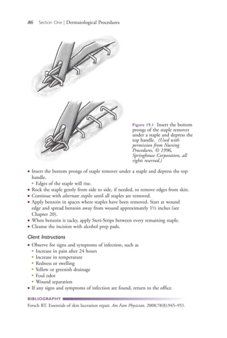 86 Section One | Dermatological Procedures
● Insert the bottom prongs of staple remover under a staple and depress the top
handle.
●
Edges of the staple will rise.
● Rock the staple gently from side to side, if needed, to remove edges from skin.
● Continue with alternate staples until all staples are removed.
● Apply benzoin in spaces where staples have been removed. Start at wound
edge and spread benzoin away from wound approximately 1½ inches (see
Chapter 20).
● When benzoin is tacky, apply Steri-Strips between every remaining staple.
● Cleanse the incision with alcohol prep pads.
Client Instructions
● Observe for signs and symptoms of infection, such as
●
Increase in pain after 24 hours
●
Increase in temperature
●
Redness or swelling
●
Yellow or greenish drainage
●
Foul odor
●
Wound separation
● If any signs and symptoms of infection are found, return to the office.
BIBLIOGRAPHY
Forsch RT. Essentials of skin laceration repair. Am Fam Physician. 2008;78(8):945–951.
Figure 19.1 Insert the bottom
prongs of the staple remover
under a staple and depress the
top handle. (Used with
permission from Nursing
Procedures, © 1996,
Springhouse Corporation, all
rights reserved.)
4206_Chapter 1_0001-0120.indd 864206_Chapter 1_0001-0120.indd 86 12/24/2014 2:01:18 PM12/24/2014 2:01:18 PM
Process CyanProcess CyanProcess MagentaProcess MagentaProcess YellowProcess YellowProcess BlackProcess Black
 