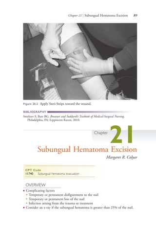 Chapter 21 | Subungual Hematoma Excision 89
BIBLIOGRAPHY
Smeltzer S, Bare BG. Brunner and Suddarth’s Textbook of Medical-Surgical Nursing.
Philadelphia, PA: Lippincott-Raven; 2010.
Chapter
21Subungual Hematoma Excision
Margaret R. Colyar
CPT Code
11740 Subungual hematoma evacuation
OVERVIEW
● Complicating factors
●
Temporary or permanent disfigurement to the nail
●
Temporary or permanent loss of the nail
●
Infection arising from the trauma or treatment
● Consider an x-ray if the subungual hematoma is greater than 25% of the nail.
Figure 20.2 Apply Steri-Strips toward the wound.
4206_Chapter 1_0001-0120.indd 894206_Chapter 1_0001-0120.indd 89 12/24/2014 2:01:19 PM12/24/2014 2:01:19 PM
Process CyanProcess CyanProcess MagentaProcess MagentaProcess YellowProcess YellowProcess BlackProcess Black
 