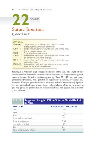 94 Section One | Dermatological Procedures
22Chapter
Suture Insertion
Cynthia Ehrhardt
CPT Code
12001–07 Simple repair, superficial wounds; scalp, neck, axillae,
external genitalia, trunk, or extremities
12011–18 Simple repair, superficial wounds; face, ears, eyelids, nose,
lips, or mucous membranes
12020 Superficial dehiscence, simple
12031–37 Intermediate repair with layer closure; scalp, axillae, trunk,
or extremities (not hands and feet)
12041–47 Intermediate repair with layer closure; neck, hands, feet, or
external genitalia
12051–57 Intermediate repair with layer closure; face, ears, eyelids,
nose, lips, or mucous membranes
Suturing is a procedure used to repair lacerations of the skin. The length of time
sutures are left in depends on location. Leaving sutures in too long or removing them
too soon increases the risk of unnecessary scarring (Table 22.1). Do not close grossly
contaminated wounds, bites, gunshot or fragmentation wounds, or wounds >12
hours old. If delayed primary closure is necessary, it should be done at day 5 postin-
jury and after debridement of dead tissue. Delayed closure allows for the wound to
pass the period of greatest risk of infection and will heal equally fast as normal
primary closure.
Table 22·1 Suggested Length of Time Sutures Should Be Left
in Place
BODY PART LENGTH OF TIME (DAYS)
Face 3–4
Neck 5
Scalp 6–7
Arms and back of hands 7
Chest and abdomen 7–10
Legs and top of feet 10
Back 10–12
Palms of hands, soles of feet 14
4206_Chapter 1_0001-0120.indd 944206_Chapter 1_0001-0120.indd 94 12/24/2014 2:01:19 PM12/24/2014 2:01:19 PM
Process CyanProcess CyanProcess MagentaProcess MagentaProcess YellowProcess YellowProcess BlackProcess Black
 