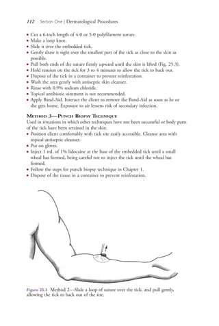 112 Section One | Dermatological Procedures
● Cut a 6-inch length of 4-0 or 5-0 polyfilament suture.
● Make a loop knot.
● Slide it over the embedded tick.
● Gently draw it tight over the smallest part of the tick as close to the skin as
possible.
● Pull both ends of the suture firmly upward until the skin is lifted (Fig. 25.3).
● Hold tension on the tick for 3 to 4 minutes to allow the tick to back out.
● Dispose of the tick in a container to prevent reinfestation.
● Wash the area gently with antiseptic skin cleanser.
● Rinse with 0.9% sodium chloride.
● Topical antibiotic ointment is not recommended.
● Apply Band-Aid. Instruct the client to remove the Band-Aid as soon as he or
she gets home. Exposure to air lessens risk of secondary infection.
METHOD 3—PUNCH BIOPSY TECHNIQUE
Used in situations in which other techniques have not been successful or body parts
of the tick have been retained in the skin.
● Position client comfortably with tick site easily accessible. Cleanse area with
topical antiseptic cleanser.
● Put on gloves.
● Inject 1 mL of 1% lidocaine at the base of the embedded tick until a small
wheal has formed, being careful not to inject the tick until the wheal has
formed.
● Follow the steps for punch biopsy technique in Chapter 1.
● Dispose of the tissue in a container to prevent reinfestation.
Figure 25.3 Method 2—Slide a loop of suture over the tick, and pull gently,
allowing the tick to back out of the site.
4206_Chapter 1_0001-0120.indd 1124206_Chapter 1_0001-0120.indd 112 12/24/2014 2:01:20 PM12/24/2014 2:01:20 PM
Process CyanProcess CyanProcess MagentaProcess MagentaProcess YellowProcess YellowProcess BlackProcess Black
 