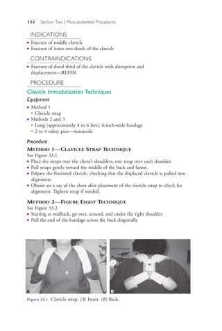 144 Section Two | Musculoskeletal Procedures
INDICATIONS
● Fracture of middle clavicle
● Fracture of inner two-thirds of the clavicle
CONTRAINDICATIONS
● Fracture of distal third of the clavicle with disruption and
displacement—REFER
PROCEDURE
Clavicle Immobilization Techniques
Equipment
● Method 1
●
Clavicle strap
● Methods 2 and 3
●
Long (approximately 4 to 6 feet), 6-inch-wide bandage
●
2 to 4 safety pins—nonsterile
Procedure
METHOD 1—CLAVICLE STRAP TECHNIQUE
See Figure 33.1.
● Place the straps over the client’s shoulders, one strap over each shoulder.
● Pull straps gently toward the middle of the back and fasten.
● Palpate the fractured clavicle, checking that the displaced clavicle is pulled into
alignment.
● Obtain an x-ray of the chest after placement of the clavicle strap to check for
alignment. Tighten strap if needed.
METHOD 2—FIGURE EIGHT TECHNIQUE
See Figure 33.2.
● Starting at midback, go over, around, and under the right shoulder.
● Pull the end of the bandage across the back diagonally.
A B
Figure 33.1 Clavicle strap. (A) Front. (B) Back.
4206_Chapter 2_0121-0204.indd 1444206_Chapter 2_0121-0204.indd 144 12/24/2014 2:01:28 PM12/24/2014 2:01:28 PM
Process CyanProcess CyanProcess MagentaProcess MagentaProcess YellowProcess YellowProcess BlackProcess Black
 