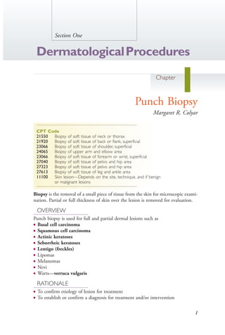 1
Section One
DermatologicalProcedures
Chapter
1Punch Biopsy
Margaret R. Colyar
CPT Code
21550 Biopsy of soft tissue of neck or thorax
21920 Biopsy of soft tissue of back or flank, superficial
23066 Biopsy of soft tissue of shoulder, superficial
24065 Biopsy of upper arm and elbow area
23066 Biopsy of soft tissue of forearm or wrist, superficial
27040 Biopsy of soft tissue of pelvis and hip area
27323 Biopsy of soft tissue of pelvis and hip area
27613 Biopsy of soft tissue of leg and ankle area
11100 Skin lesion—Depends on the site, technique, and if benign
or malignant lesions
Biopsy is the removal of a small piece of tissue from the skin for microscopic exami-
nation. Partial or full thickness of skin over the lesion is removed for evaluation.
OVERVIEW
Punch biopsy is used for full and partial dermal lesions such as
● Basal cell carcinoma
● Squamous cell carcinoma
● Actinic keratoses
● Seborrheic keratoses
● Lentigo (freckles)
● Lipomas
● Melanomas
● Nevi
● Warts—verruca vulgaris
RATIONALE
● To confirm etiology of lesion for treatment
● To establish or confirm a diagnosis for treatment and/or intervention
4206_Chapter 1_0001-0120.indd 14206_Chapter 1_0001-0120.indd 1 12/24/2014 2:01:14 PM12/24/2014 2:01:14 PM
Process CyanProcess CyanProcess MagentaProcess MagentaProcess YellowProcess YellowProcess BlackProcess Black
 