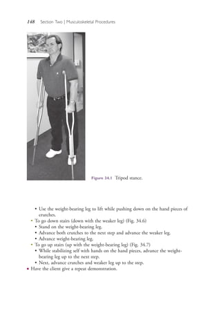 148 Section Two | Musculoskeletal Procedures
Figure 34.1 Tripod stance.
• Use the weight-bearing leg to lift while pushing down on the hand pieces of
crutches.
●
To go down stairs (down with the weaker leg) (Fig. 34.6)
• Stand on the weight-bearing leg.
• Advance both crutches to the next step and advance the weaker leg.
• Advance weight-bearing leg.
●
To go up stairs (up with the weight-bearing leg) (Fig. 34.7)
• While stabilizing self with hands on the hand pieces, advance the weight-
bearing leg up to the next step.
• Next, advance crutches and weaker leg up to the step.
● Have the client give a repeat demonstration.
4206_Chapter 2_0121-0204.indd 1484206_Chapter 2_0121-0204.indd 148 12/24/2014 2:01:28 PM12/24/2014 2:01:28 PM
Process CyanProcess CyanProcess MagentaProcess MagentaProcess YellowProcess YellowProcess BlackProcess Black
 