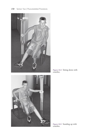 150 Section Two | Musculoskeletal Procedures
Figure 34.5 Standing up with
crutches.
Figure 34.4 Sitting down with
crutches.
4206_Chapter 2_0121-0204.indd 1504206_Chapter 2_0121-0204.indd 150 12/24/2014 2:01:28 PM12/24/2014 2:01:28 PM
Process CyanProcess CyanProcess MagentaProcess MagentaProcess YellowProcess YellowProcess BlackProcess Black
 