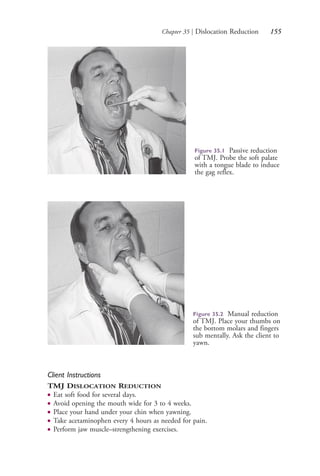 Chapter 35 | Dislocation Reduction 155
Figure 35.1 Passive reduction
of TMJ. Probe the soft palate
with a tongue blade to induce
the gag reflex.
Figure 35.2 Manual reduction
of TMJ. Place your thumbs on
the bottom molars and fingers
sub mentally. Ask the client to
yawn.
Client Instructions
TMJ DISLOCATION REDUCTION
● Eat soft food for several days.
● Avoid opening the mouth wide for 3 to 4 weeks.
● Place your hand under your chin when yawning.
● Take acetaminophen every 4 hours as needed for pain.
● Perform jaw muscle–strengthening exercises.
4206_Chapter 2_0121-0204.indd 1554206_Chapter 2_0121-0204.indd 155 12/24/2014 2:01:29 PM12/24/2014 2:01:29 PM
Process CyanProcess CyanProcess MagentaProcess MagentaProcess YellowProcess YellowProcess BlackProcess Black
 