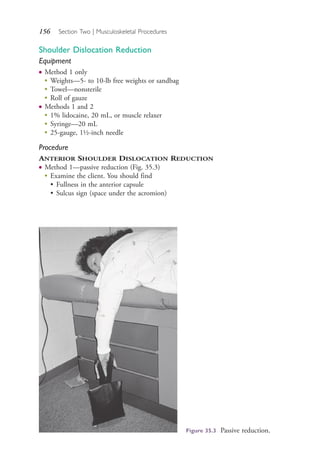 156 Section Two | Musculoskeletal Procedures
Shoulder Dislocation Reduction
Equipment
● Method 1 only
●
Weights—5- to 10-lb free weights or sandbag
●
Towel—nonsterile
●
Roll of gauze
● Methods 1 and 2
●
1% lidocaine, 20 mL, or muscle relaxer
●
Syringe—20 mL
●
25-gauge, 1½-inch needle
Procedure
ANTERIOR SHOULDER DISLOCATION REDUCTION
● Method 1—passive reduction (Fig. 35.3)
●
Examine the client. You should find
• Fullness in the anterior capsule
• Sulcus sign (space under the acromion)
Figure 35.3 Passive reduction.
4206_Chapter 2_0121-0204.indd 1564206_Chapter 2_0121-0204.indd 156 12/24/2014 2:01:29 PM12/24/2014 2:01:29 PM
Process CyanProcess CyanProcess MagentaProcess MagentaProcess YellowProcess YellowProcess BlackProcess Black
 