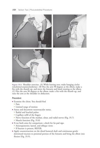 160 Section Two | Musculoskeletal Procedures
Procedure
● Examine the client. You should find
●
Pain
●
Limited range of motion
● Assess and document neurovascular status.
●
Radial and brachial pulses
●
Capillary refill of the fingers
●
Nerve function of the median, ulnar, and radial nerves (Fig. 35.7)
●
Muscle function (Fig. 35.8)
● X-ray both arms for comparison—check for fat pad sign.
●
Anteroposterior, lateral, and oblique views
●
If fracture is present, REFER.
● Apply countertraction on the distal humeral shaft and continuous gentle
downward traction to proximal portion of the forearm and bring the elbow into
flexion (Fig. 35.9).
Figure 35.6 Shoulder exercises. (A) While leaning over, make hanging circles
(clockwise/counterclockwise). (B) Flex the arm 90 degrees at the elbow, make a
fist with the thumb up, and move the forearm and hand rotating at the elbow.
(C) Flex the arm 90 degrees at the elbow, make a fist with the thumb up, and
raise the arm at the shoulder in abduction.
B
C
AA
4206_Chapter 2_0121-0204.indd 1604206_Chapter 2_0121-0204.indd 160 12/24/2014 2:01:29 PM12/24/2014 2:01:29 PM
Process CyanProcess CyanProcess MagentaProcess MagentaProcess YellowProcess YellowProcess BlackProcess Black
 