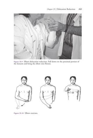 Chapter 35 | Dislocation Reduction 163
Figure 35.9 Elbow dislocation reduction. Pull down on the proximal portion of
the forearm and bring the elbow into flexion.
Figure 35.10 Elbow exercises.
4206_Chapter 2_0121-0204.indd 1634206_Chapter 2_0121-0204.indd 163 12/24/2014 2:01:30 PM12/24/2014 2:01:30 PM
Process CyanProcess CyanProcess MagentaProcess MagentaProcess YellowProcess YellowProcess BlackProcess Black
 