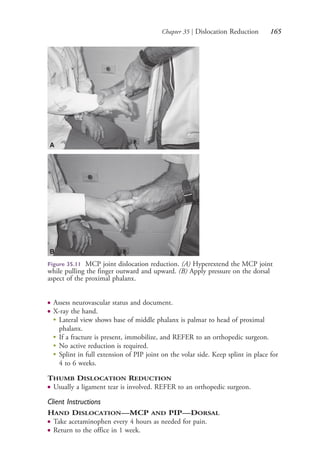 Chapter 35 | Dislocation Reduction 165
Figure 35.11 MCP joint dislocation reduction. (A) Hyperextend the MCP joint
while pulling the finger outward and upward. (B) Apply pressure on the dorsal
aspect of the proximal phalanx.
A
B
● Assess neurovascular status and document.
● X-ray the hand.
●
Lateral view shows base of middle phalanx is palmar to head of proximal
phalanx.
●
If a fracture is present, immobilize, and REFER to an orthopedic surgeon.
●
No active reduction is required.
●
Splint in full extension of PIP joint on the volar side. Keep splint in place for
4 to 6 weeks.
THUMB DISLOCATION REDUCTION
● Usually a ligament tear is involved. REFER to an orthopedic surgeon.
Client Instructions
HAND DISLOCATION—MCP AND PIP—DORSAL
● Take acetaminophen every 4 hours as needed for pain.
● Return to the office in 1 week.
4206_Chapter 2_0121-0204.indd 1654206_Chapter 2_0121-0204.indd 165 12/24/2014 2:01:30 PM12/24/2014 2:01:30 PM
Process CyanProcess CyanProcess MagentaProcess MagentaProcess YellowProcess YellowProcess BlackProcess Black
 