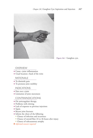Chapter 36 | Ganglion Cyst Aspiration and Injection 167
Figure 36.1 Ganglion cyst.
OVERVIEW
● Cause—joint inflammation
● Usual location—back of the wrist
RATIONALE
● To diminish pain
● To promote joint mobility
INDICATIONS
● Pain over a joint
● Limitation of joint movement
CONTRAINDICATIONS
● On anticoagulant therapy
● Problems with clotting
● Lack of response to previous injections
● Sepsis
● Recent joint fractures
● Inform the client of the following
●
Chance of infection and recurrence
●
Chance of steroid flare 24 to 36 hours after injury
●
Chance of subcutaneous atrophy
◗ Informed consent required
4206_Chapter 2_0121-0204.indd 1674206_Chapter 2_0121-0204.indd 167 12/24/2014 2:01:30 PM12/24/2014 2:01:30 PM
Process CyanProcess CyanProcess MagentaProcess MagentaProcess YellowProcess YellowProcess BlackProcess Black
 