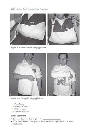 182 Section Two | Musculoskeletal Procedures
Figure 38.2 Triangular sling application.
●
Paresthesias
●
Warmth of hand
●
Color of hand
●
Presence of edema
Client Instructions
● You must keep the sling in place for _________________.
● If the hand becomes cold, pale in color, numb, or tingly, contact the nurse
practitioner.
Figure 38.1 Manufactured sling application.
A B
A B
4206_Chapter 2_0121-0204.indd 1824206_Chapter 2_0121-0204.indd 182 12/24/2014 2:01:31 PM12/24/2014 2:01:31 PM
Process CyanProcess CyanProcess MagentaProcess MagentaProcess YellowProcess YellowProcess BlackProcess Black
 