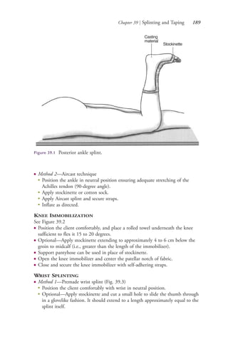 Chapter 39 | Splinting and Taping 189
Casting
material
Stockinette
Figure 39.1 Posterior ankle splint.
● Method 2—Aircast technique
●
Position the ankle in neutral position ensuring adequate stretching of the
Achilles tendon (90-degree angle).
●
Apply stockinette or cotton sock.
●
Apply Aircast splint and secure straps.
●
Inflate as directed.
KNEE IMMOBILIZATION
See Figure 39.2
● Position the client comfortably, and place a rolled towel underneath the knee
sufficient to flex it 15 to 20 degrees.
● Optional—Apply stockinette extending to approximately 4 to 6 cm below the
groin to midcalf (i.e., greater than the length of the immobilizer).
● Support pantyhose can be used in place of stockinette.
● Open the knee immobilizer and center the patellar notch of fabric.
● Close and secure the knee immobilizer with self-adhering straps.
WRIST SPLINTING
● Method 1—Premade wrist splint (Fig. 39.3)
●
Position the client comfortably with wrist in neutral position.
●
Optional—Apply stockinette and cut a small hole to slide the thumb through
in a glovelike fashion. It should extend to a length approximately equal to the
splint itself.
4206_Chapter 2_0121-0204.indd 1894206_Chapter 2_0121-0204.indd 189 12/24/2014 2:01:31 PM12/24/2014 2:01:31 PM
Process CyanProcess CyanProcess MagentaProcess MagentaProcess YellowProcess YellowProcess BlackProcess Black
 