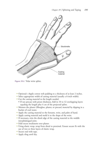 Chapter 39 | Splinting and Taping 191
Stockinette
Casting
material
Figure 39.4 Volar wrist splint.
●
Optional—Apply cotton web padding to a thickness of at least 2 inches.
●
Select appropriate width of casting material (usually a 6-inch width).
●
Cut the casting material to the length needed.
• If not precast with preset thickness, fold in 10 to 12 overlapping layers
equaling the length plus 4 cm of the projected splint.
●
Moisten the plaster (fiberglass, plaster, or precast) material by dipping in a
bucket of cool water.
●
Apply the casting material to the forearm, wrist, and palm of hand.
●
Apply casting material and mold it to the shape of the wrist.
●
If necessary, trim the distal edge of the casting material to the middle
interphalangeal joint.
●
Fold excess stockinette over plaster.
●
Using elastic wrap, wrap from distal to proximal. Ensure secure fit with the
use of two or three layers of elastic wrap.
●
Secure end with tape.
●
Apply sling until dry.
4206_Chapter 2_0121-0204.indd 1914206_Chapter 2_0121-0204.indd 191 12/24/2014 2:01:31 PM12/24/2014 2:01:31 PM
Process CyanProcess CyanProcess MagentaProcess MagentaProcess YellowProcess YellowProcess BlackProcess Black
 