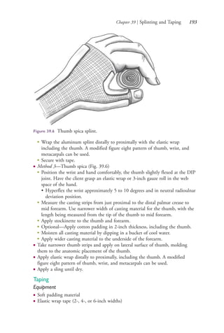 Chapter 39 | Splinting and Taping 193
Figure 39.6 Thumb spica splint.
●
Wrap the aluminum splint distally to proximally with the elastic wrap
including the thumb. A modified figure eight pattern of thumb, wrist, and
metacarpals can be used.
●
Secure with tape.
● Method 3—Thumb spica (Fig. 39.6)
●
Position the wrist and hand comfortably, the thumb slightly flexed at the DIP
joint. Have the client grasp an elastic wrap or 3-inch gauze roll in the web
space of the hand.
• Hyperflex the wrist approximately 5 to 10 degrees and in neutral radioulnar
deviation position.
●
Measure the casting strips from just proximal to the distal palmar crease to
mid forearm. Use narrower width of casting material for the thumb, with the
length being measured from the tip of the thumb to mid forearm.
● Apply stockinette to the thumb and forearm.
●
Optional—Apply cotton padding in 2-inch thickness, including the thumb.
●
Moisten all casting material by dipping in a bucket of cool water.
●
Apply wider casting material to the underside of the forearm.
● Take narrower thumb strips and apply on lateral surface of thumb, molding
them to the anatomic placement of the thumb.
● Apply elastic wrap distally to proximally, including the thumb. A modified
figure eight pattern of thumb, wrist, and metacarpals can be used.
● Apply a sling until dry.
Taping
Equipment
● Soft padding material
● Elastic wrap tape (2-, 4-, or 6-inch widths)
4206_Chapter 2_0121-0204.indd 1934206_Chapter 2_0121-0204.indd 193 12/24/2014 2:01:32 PM12/24/2014 2:01:32 PM
Process CyanProcess CyanProcess MagentaProcess MagentaProcess YellowProcess YellowProcess BlackProcess Black
 