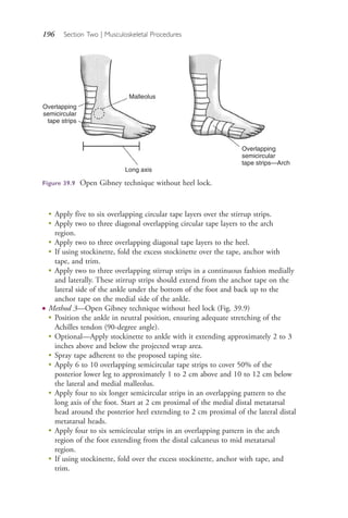196 Section Two | Musculoskeletal Procedures
●
Apply five to six overlapping circular tape layers over the stirrup strips.
●
Apply two to three diagonal overlapping circular tape layers to the arch
region.
●
Apply two to three overlapping diagonal tape layers to the heel.
●
If using stockinette, fold the excess stockinette over the tape, anchor with
tape, and trim.
●
Apply two to three overlapping stirrup strips in a continuous fashion medially
and laterally. These stirrup strips should extend from the anchor tape on the
lateral side of the ankle under the bottom of the foot and back up to the
anchor tape on the medial side of the ankle.
● Method 3—Open Gibney technique without heel lock (Fig. 39.9)
●
Position the ankle in neutral position, ensuring adequate stretching of the
Achilles tendon (90-degree angle).
●
Optional—Apply stockinette to ankle with it extending approximately 2 to 3
inches above and below the projected wrap area.
●
Spray tape adherent to the proposed taping site.
●
Apply 6 to 10 overlapping semicircular tape strips to cover 50% of the
posterior lower leg to approximately 1 to 2 cm above and 10 to 12 cm below
the lateral and medial malleolus.
● Apply four to six longer semicircular strips in an overlapping pattern to the
long axis of the foot. Start at 2 cm proximal of the medial distal metatarsal
head around the posterior heel extending to 2 cm proximal of the lateral distal
metatarsal heads.
● Apply four to six semicircular strips in an overlapping pattern in the arch
region of the foot extending from the distal calcaneus to mid metatarsal
region.
● If using stockinette, fold over the excess stockinette, anchor with tape, and
trim.
Overlapping
semicircular
tape strips
Malleolus
Long axis
Overlapping
semicircular
tape strips—Arch
Figure 39.9 Open Gibney technique without heel lock.
4206_Chapter 2_0121-0204.indd 1964206_Chapter 2_0121-0204.indd 196 12/24/2014 2:01:32 PM12/24/2014 2:01:32 PM
Process CyanProcess CyanProcess MagentaProcess MagentaProcess YellowProcess YellowProcess BlackProcess Black
 
