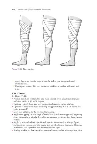 198 Section Two | Musculoskeletal Procedures
●
Apply five to six circular strips across the arch region to approximately
midmetatarsal.
●
If using stockinette, fold over the excess stockinette, anchor with tape, and
trim.
KNEE TAPING
See Figure 39.11.
● Position the client comfortably, and place a rolled towel underneath the knee
sufficient to flex it 15 to 20 degrees.
● Optional—Apply foam pad over the popliteal space to reduce chafing.
● Optional—Apply stockinette extending to approximately 4 to 6 cm below the
groin to midcalf.
● Spray tape adherent to the proposed taping site.
● Apply overlapping circular strips of tape (2- or 3-inch tape suggested) beginning
either proximally or distally depending on personal preference in a basket-weave
pattern.
● Apply 3- to 4-inch elastic tape (4-inch tape recommended) in a larger figure
eight pattern, crossing over the medial and lateral collateral ligaments. This may
be repeated in a layered fashion for three to four layers.
● If using stockinette, fold over the excess stockinette, anchor with tape, and trim.
Figure 39.11 Knee taping.
4206_Chapter 2_0121-0204.indd 1984206_Chapter 2_0121-0204.indd 198 12/24/2014 2:01:32 PM12/24/2014 2:01:32 PM
Process CyanProcess CyanProcess MagentaProcess MagentaProcess YellowProcess YellowProcess BlackProcess Black
 