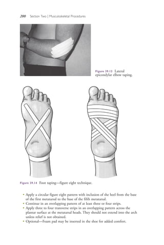 200 Section Two | Musculoskeletal Procedures
●
Apply a circular figure eight pattern with inclusion of the heel from the base
of the first metatarsal to the base of the fifth metatarsal.
●
Continue in an overlapping pattern of at least three or four strips.
●
Apply three to four transverse strips in an overlapping pattern across the
plantar surface at the metatarsal heads. They should not extend into the arch
unless relief is not obtained.
●
Optional—Foam pad may be inserted in the shoe for added comfort.
Figure 39.13 Lateral
epicondylar elbow taping.
Figure 39.14 Foot taping—figure eight technique.
4206_Chapter 2_0121-0204.indd 2004206_Chapter 2_0121-0204.indd 200 12/24/2014 2:01:33 PM12/24/2014 2:01:33 PM
Process CyanProcess CyanProcess MagentaProcess MagentaProcess YellowProcess YellowProcess BlackProcess Black
 