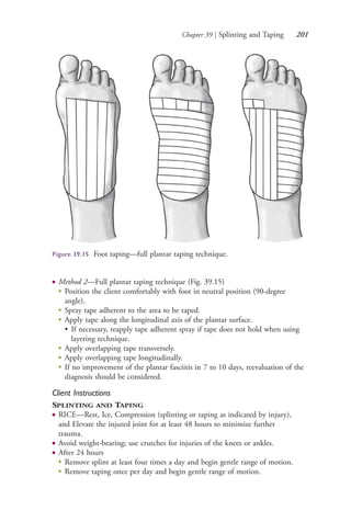 Chapter 39 | Splinting and Taping 201
● Method 2—Full plantar taping technique (Fig. 39.15)
● Position the client comfortably with foot in neutral position (90-degree
angle).
● Spray tape adherent to the area to be taped.
● Apply tape along the longitudinal axis of the plantar surface.
• If necessary, reapply tape adherent spray if tape does not hold when using
layering technique.
● Apply overlapping tape transversely.
● Apply overlapping tape longitudinally.
●
If no improvement of the plantar fasciitis in 7 to 10 days, reevaluation of the
diagnosis should be considered.
Client Instructions
SPLINTING AND TAPING
● RICE—Rest, Ice, Compression (splinting or taping as indicated by injury),
and Elevate the injured joint for at least 48 hours to minimize further
trauma.
● Avoid weight-bearing; use crutches for injuries of the knees or ankles.
● After 24 hours
●
Remove splint at least four times a day and begin gentle range of motion.
●
Remove taping once per day and begin gentle range of motion.
Figure 39.15 Foot taping—full plantar taping technique.
4206_Chapter 2_0121-0204.indd 2014206_Chapter 2_0121-0204.indd 201 12/24/2014 2:01:33 PM12/24/2014 2:01:33 PM
Process CyanProcess CyanProcess MagentaProcess MagentaProcess YellowProcess YellowProcess BlackProcess Black
 