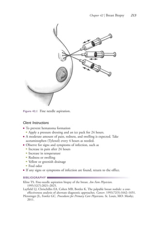 Chapter 42 | Breast Biopsy 213
Client Instructions
● To prevent hematoma formation
●
Apply a pressure dressing and an ice pack for 24 hours.
● A moderate amount of pain, redness, and swelling is expected. Take
acetaminophen (Tylenol) every 4 hours as needed.
● Observe for signs and symptoms of infection, such as
●
Increase in pain after 24 hours
● Increase in temperature
●
Redness or swelling
●
Yellow or greenish drainage
●
Foul odor
● If any signs or symptoms of infection are found, return to the office.
BIBLIOGRAPHY
Kline TS. Fine-needle aspiration biopsy of the breast. Am Fam Physician.
1995;52(7):2021–2025.
Layfield LJ, Chrischilles EA, Cohen MB, Bottles K. The palpable breast nodule: a cost-
effectiveness analysis of alternate diagnostic approaches. Cancer. 1993;72(5):1642–1651.
Pfenninger JL, Fowler GC. Procedures for Primary Care Physicians. St. Louis, MO: Mosby;
2011.
Figure 42.1 Fine needle aspiration.
4206_Chapter 3_0205-0312.indd 2134206_Chapter 3_0205-0312.indd 213 12/24/2014 2:01:40 PM12/24/2014 2:01:40 PM
Process CyanProcess CyanProcess MagentaProcess MagentaProcess YellowProcess YellowProcess BlackProcess Black
 