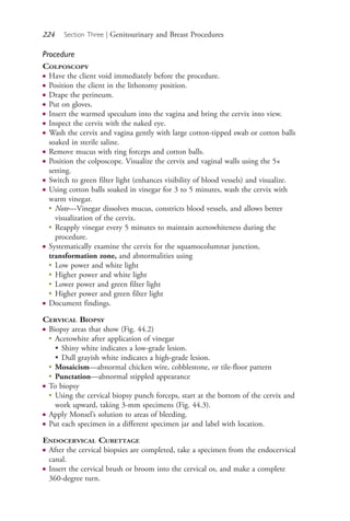 224 Section Three | Genitourinary and Breast Procedures
Procedure
COLPOSCOPY
● Have the client void immediately before the procedure.
● Position the client in the lithotomy position.
● Drape the perineum.
● Put on gloves.
● Insert the warmed speculum into the vagina and bring the cervix into view.
● Inspect the cervix with the naked eye.
● Wash the cervix and vagina gently with large cotton-tipped swab or cotton balls
soaked in sterile saline.
● Remove mucus with ring forceps and cotton balls.
● Position the colposcope. Visualize the cervix and vaginal walls using the 5×
setting.
● Switch to green filter light (enhances visibility of blood vessels) and visualize.
● Using cotton balls soaked in vinegar for 3 to 5 minutes, wash the cervix with
warm vinegar.
●
Note—Vinegar dissolves mucus, constricts blood vessels, and allows better
visualization of the cervix.
●
Reapply vinegar every 5 minutes to maintain acetowhiteness during the
procedure.
● Systematically examine the cervix for the squamocolumnar junction,
transformation zone, and abnormalities using
●
Low power and white light
●
Higher power and white light
●
Lower power and green filter light
●
Higher power and green filter light
● Document findings.
CERVICAL BIOPSY
● Biopsy areas that show (Fig. 44.2)
●
Acetowhite after application of vinegar
• Shiny white indicates a low-grade lesion.
• Dull grayish white indicates a high-grade lesion.
●
Mosaicism—abnormal chicken wire, cobblestone, or tile-floor pattern
●
Punctation—abnormal stippled appearance
● To biopsy
●
Using the cervical biopsy punch forceps, start at the bottom of the cervix and
work upward, taking 3-mm specimens (Fig. 44.3).
● Apply Monsel’s solution to areas of bleeding.
● Put each specimen in a different specimen jar and label with location.
ENDOCERVICAL CURETTAGE
● After the cervical biopsies are completed, take a specimen from the endocervical
canal.
● Insert the cervical brush or broom into the cervical os, and make a complete
360-degree turn.
4206_Chapter 3_0205-0312.indd 2244206_Chapter 3_0205-0312.indd 224 12/24/2014 2:01:41 PM12/24/2014 2:01:41 PM
Process CyanProcess CyanProcess MagentaProcess MagentaProcess YellowProcess YellowProcess BlackProcess Black
 