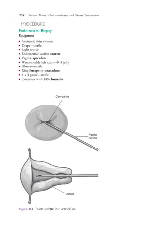 228 Section Three | Genitourinary and Breast Procedures
PROCEDURE
Endometrial Biopsy
Equipment
● Antiseptic skin cleanser
● Drape—sterile
● Light source
● Endometrial suction curette
● Vaginal speculum
● Water-soluble lubricant—K-Y jelly
● Gloves—sterile
● Ring forceps or tenaculum
● 4 × 4 gauze—sterile
● Container with 10% formalin
Cervical os
Pipelle
curette
Uterus
Figure 45.1 Insert curette into cervical os.
4206_Chapter 3_0205-0312.indd 2284206_Chapter 3_0205-0312.indd 228 12/24/2014 2:01:41 PM12/24/2014 2:01:41 PM
Process CyanProcess CyanProcess MagentaProcess MagentaProcess YellowProcess YellowProcess BlackProcess Black
 