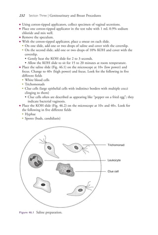 232 Section Three | Genitourinary and Breast Procedures
● Using cotton-tipped applicators, collect specimen of vaginal secretions.
● Place one cotton-tipped applicator in the test tube with 1 mL 0.9% sodium
chloride and mix well.
● Remove the speculum.
● With the cotton-tipped applicator, place a smear on each slide.
●
On one slide, add one or two drops of saline and cover with the coverslip.
●
On the second slide, add one or two drops of 10% KOH and cover with the
coverslip.
• Gently heat the KOH slide for 2 to 3 seconds.
• Allow the KOH slide to sit for 15 to 20 minutes at room temperature.
● Place the saline slide (Fig. 46.1) on the microscope at 10× (low power) and
focus. Change to 40× (high power) and focus. Look for the following in five
different fields
●
White blood cells
●
Trichomonads
●
Clue cells (large epithelial cells with indistinct borders with multiple cocci
clinging to them)
• Clue cells often are described as appearing like “pepper on a fried egg”; they
indicate bacterial vaginosis.
● Place the KOH slide (Fig. 46.2) on the microscope at 10× and 40×. Look for
the following in five different fields
●
Hyphae
●
Spores (buds, candidiasis)
Trichomonad
Leukocyte
Clue cell
Figure 46.1 Saline preparation.
4206_Chapter 3_0205-0312.indd 2324206_Chapter 3_0205-0312.indd 232 12/24/2014 2:01:41 PM12/24/2014 2:01:41 PM
Process CyanProcess CyanProcess MagentaProcess MagentaProcess YellowProcess YellowProcess BlackProcess Black
 