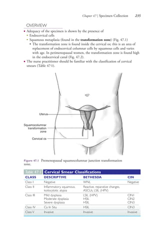 Chapter 47 | Specimen Collection 235
OVERVIEW
● Adequacy of the specimen is shown by the presence of
●
Endocervical cells
●
Squamous metaplasia (found in the transformation zone) (Fig. 47.1)
• The transformation zone is found inside the cervical os; this is an area of
replacement of endocervical columnar cells by squamous cells and varies
with age. In perimenopausal women, the transformation zone is found high
in the endocervical canal (Fig. 47.2).
● The nurse practitioner should be familiar with the classification of cervical
smears (Table 47.1).
Table 47·1 Cervical Smear Classifications
CLASS DESCRIPTIVE BETHESDA CIN
Class I Negative WNL Negative
Class II Inflammatory, squamous,
koilocytotic atypia
Reactive, reparative changes,
ASCUs, LSIL (HPV)
Class III Mild dysplasia
Moderate dysplasia
Severe dysplasia
LSIL (HPV)
HSIL
HSIL
CIN1
CIN2
CIN3
Class IV Ca In Situ HSIL CIN3
Class V Invasive Invasive Invasive
Uterus
Squamocolumnar
transformation
zone
Cervical os
Figure 47.1 Premenopausal squamocolumnar junction transformation
zone.
4206_Chapter 3_0205-0312.indd 2354206_Chapter 3_0205-0312.indd 235 12/24/2014 2:01:41 PM12/24/2014 2:01:41 PM
Process CyanProcess CyanProcess MagentaProcess MagentaProcess YellowProcess YellowProcess BlackProcess Black
 