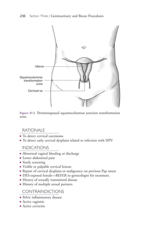 236 Section Three | Genitourinary and Breast Procedures
RATIONALE
● To detect cervical carcinoma
● To detect early cervical dysplasia related to infection with HPV
INDICATIONS
● Abnormal vaginal bleeding or discharge
● Lower abdominal pain
● Yearly screening
● Visible or palpable cervical lesions
● Report of cervical dysplasia or malignancy on previous Pap smear
● DES-exposed female—REFER to gynecologist for treatment.
● History of sexually transmitted disease
● History of multiple sexual partners
CONTRAINDICTIONS
● Pelvic inflammatory disease
● Active vaginitis
● Active cervicitis
Uterus
Squamocolumnar
transformation
zone
Cervical os
Figure 47.2 Perimenopausal squamocolumnar junction transformation
zone.
4206_Chapter 3_0205-0312.indd 2364206_Chapter 3_0205-0312.indd 236 12/24/2014 2:01:41 PM12/24/2014 2:01:41 PM
Process CyanProcess CyanProcess MagentaProcess MagentaProcess YellowProcess YellowProcess BlackProcess Black
 