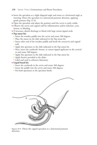 238 Section Three | Genitourinary and Breast Procedures
● Insert the speculum at a slight diagonal angle and rotate to a horizontal angle as
inserting. Direct the speculum in a downward posterior direction, applying
gentle pressure (Fig. 47.4).
● Open the speculum and adjust the position until the cervix is easily visible.
● Observe the cervix and vaginal wall for inflammation and/or infection, cysts,
lesions, or bleeding.
● If necessary, absorb discharge or blood with large cotton-tipped swab.
● Pap smear kit:
●
Insert the wooden paddle into the cervix and rotate 360 degrees.
●
Place the smear on the slide indicated in the Pap smear kit.
●
Insert other end of the wooden paddle and brush the ectocervix and vaginal
wall.
●
Apply this specimen to the slide indicated in the Pap smear kit.
●
Next, insert the cytobrush, broom, or cotton-tipped applicator in the cervical
os and rotate 360 degrees.
●
Apply this specimen to the slide indicated in the Pap smear kit.
●
Apply fixative provided to the slides.
●
Label and send to reference laboratory.
● Liquid based kit:
●
Insert the cytobrush in the cervix and rotate 360 degrees.
●
Insert the paddle into the cervix and rotate 360 degrees.
●
Put both specimens in the specimen bottle.
Figure 47-4 Direct the vaginal speculum in a downward posterior
direction.
4206_Chapter 3_0205-0312.indd 2384206_Chapter 3_0205-0312.indd 238 12/24/2014 2:01:41 PM12/24/2014 2:01:41 PM
Process CyanProcess CyanProcess MagentaProcess MagentaProcess YellowProcess YellowProcess BlackProcess Black
 