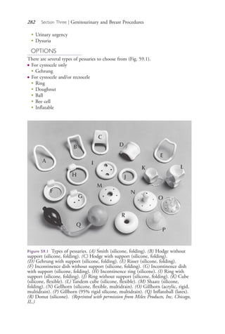 282 Section Three | Genitourinary and Breast Procedures
●
Urinary urgency
●
Dysuria
OPTIONS
There are several types of pessaries to choose from (Fig. 59.1).
● For cystocele only
●
Gehrung
● For cystocele and/or rectocele
●
Ring
●
Doughnut
●
Ball
●
Bee cell
●
Inflatable
Figure 59.1 Types of pessaries. (A) Smith (silicone, folding). (B) Hodge without
support (silicone, folding). (C) Hodge with support (silicone, folding).
(D) Gehrung with support (silicone, folding). (E) Risser (silicone, folding).
(F) Incontinence dish without support (silicone, folding). (G) Incontinence dish
with support (silicone, folding). (H) Incontinence ring (silicone). (I) Ring with
support (silicone, folding). (J) Ring without support (silicone, folding). (K) Cube
(silicone, flexible). (L) Tandem cube (silicone, flexible). (M) Shaatz (silicone,
folding). (N) Gellhorn (silicone, flexible, multidrain). (O) Gillhorn (acrylic, rigid,
multidrain). (P) Gillhorn (95% rigid silicone, multidrain). (Q) Inflatoball (latex).
(R) Donut (silicone). (Reprinted with permission from Milex Products, Inc, Chicago,
IL.)
4206_Chapter 3_0205-0312.indd 2824206_Chapter 3_0205-0312.indd 282 12/24/2014 2:01:43 PM12/24/2014 2:01:43 PM
Process CyanProcess CyanProcess MagentaProcess MagentaProcess YellowProcess YellowProcess BlackProcess Black
 