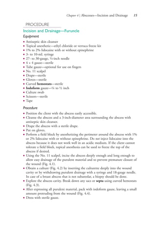 Chapter 4 | Abscesses—Incision and Drainage 15
PROCEDURE
Incision and Drainage—Furuncle
Equipment
● Antiseptic skin cleanser
● Topical anesthetic—ethyl chloride or verruca freeze kit
● 1% to 2% lidocaine with or without epinephrine
● 3- to 10-mL syringe
● 27- to 30-gauge, ½-inch needle
● 4 × 4 gauze—sterile
● Tube gauze—optional for use on fingers
● No. 11 scalpel
● Drape—sterile
● Gloves—sterile
● Curved hemostats—sterile
● Iodoform gauze—¼ to ½ inch
● Culture swab
● Scissors—sterile
● Tape
Procedure
● Position the client with the abscess easily accessible.
● Cleanse the abscess and a 3-inch-diameter area surrounding the abscess with
antiseptic skin cleanser.
● Drape the abscess with a sterile drape.
● Put on gloves.
● Perform a field block by anesthetizing the perimeter around the abscess with 1%
or 2% lidocaine with or without epinephrine. Do not inject lidocaine into the
abscess because it does not work well in an acidic medium. If the client cannot
tolerate a field block, topical anesthesia can be used to freeze the top of the
abscess if desired.
● Using the No. 11 scalpel, incise the abscess deeply enough and long enough to
allow easy drainage of the purulent material and to prevent premature closure of
the wound (Fig. 4.1).
● Obtain a culture (Fig. 4.2) by inserting the culturette deeply into the wound
cavity or by withdrawing purulent drainage with a syringe and 18-gauge needle.
In case of a breast abscess that is not subareolar, a biopsy should be done.
● Explore the abscess cavity. Break down any sacs or septa using curved hemostats
(Fig. 4.3).
● After expressing all purulent material, pack with iodoform gauze, leaving a small
amount protruding from the wound (Fig. 4.4).
● Dress with sterile gauze.
4206_Chapter 1_0001-0120.indd 154206_Chapter 1_0001-0120.indd 15 12/24/2014 2:01:15 PM12/24/2014 2:01:15 PM
Process CyanProcess CyanProcess MagentaProcess MagentaProcess YellowProcess YellowProcess BlackProcess Black
 