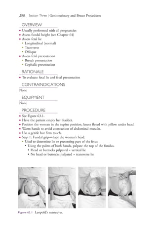 298 Section Three | Genitourinary and Breast Procedures
OVERVIEW
● Usually performed with all pregnancies
● Assess fundal height (see Chapter 64)
● Assess fetal lie
●
Longitudinal (normal)
●
Transverse
●
Oblique
● Assess fetal presentation
●
Breech presentation
● Cephalic presentation
RATIONALE
● To evaluate fetal lie and fetal presentation
CONTRAINDICATIONS
None
EQUIPMENT
None
PROCEDURE
● See Figure 63.1.
● Have the patient empty her bladder.
● Position the woman in the supine position, knees flexed with pillow under head.
● Warm hands to avoid contraction of abdominal muscles.
● Use a gentle but firm touch.
● Step 1: Fundal grip—Face the woman’s head.
●
Used to determine lie or presenting part of the fetus
• Using the palms of both hands, palpate the top of the fundus.
• Head or buttocks palpated = vertical lie
• No head or buttocks palpated = transverse lie
Figure 63.1 Leopold’s maneuver.
4206_Chapter 3_0205-0312.indd 2984206_Chapter 3_0205-0312.indd 298 12/24/2014 2:01:44 PM12/24/2014 2:01:44 PM
Process CyanProcess CyanProcess MagentaProcess MagentaProcess YellowProcess YellowProcess BlackProcess Black
 