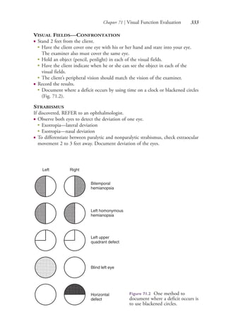 Chapter 71 | Visual Function Evaluation 333
VISUAL FIELDS—CONFRONTATION
● Stand 2 feet from the client.
●
Have the client cover one eye with his or her hand and stare into your eye.
The examiner also must cover the same eye.
●
Hold an object (pencil, penlight) in each of the visual fields.
●
Have the client indicate when he or she can see the object in each of the
visual fields.
●
The client’s peripheral vision should match the vision of the examiner.
● Record the results.
●
Document where a deficit occurs by using time on a clock or blackened circles
(Fig. 71.2).
STRABISMUS
If discovered, REFER to an ophthalmologist.
● Observe both eyes to detect the deviation of one eye.
●
Exotropia—lateral deviation
●
Esotropia—nasal deviation
● To differentiate between paralytic and nonparalytic strabismus, check extraocular
movement 2 to 3 feet away. Document deviation of the eyes.
Left Right
Bitemporal
hemianopsia
Left homonymous
hemianopsia
Left upper
quadrant defect
Blind left eye
Horizontal
defect
Figure 71.2 One method to
document where a deficit occurs is
to use blackened circles.
4206_Chapter 4_0313-0402.indd 3334206_Chapter 4_0313-0402.indd 333 12/25/2014 4:46:54 PM12/25/2014 4:46:54 PM
Process CyanProcess CyanProcess MagentaProcess MagentaProcess YellowProcess YellowProcess BlackProcess Black
 