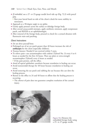 340 Section Four | Head: Eyes, Ears, Nose, and Mouth
● If embedded, use a 27- or 25-gauge needle bevel side up (Fig. 72.2) with pencil
grip.
●
Rest your lateral hand on side of the client’s cheek for more stability in
movement.
● Approach at a 90-degree angle to eye globe.
● Gently apply pressure across the surface to dislodge foreign body.
● After several unsuccessful attempts, apply antibiotic ointment, apply nonpressure
patch, and REFER to an ophthalmologist.
● After removal of the foreign body, proceed to check for a corneal abrasion with
fluorescein stain and patching.
Client Instructions
● Do not drive yourself home.
● Prolonged use of an eye patch greater than 48 hours increases the risk of
amblyopia for the client (especially children).
● Tetanus booster: Needed if not received within 5 years.
● To relieve pain—use acetaminophen with codeine (Tylenol No. 3) every 4 to 6
hours as needed for the first 24 hours. Then use plain or extra-strength
acetaminophen (Tylenol) every 4 hours as needed.
●
If the pain persists, call the office.
● Avoid all topical ophthalmic anesthetics because retardation in healing can occur.
● Avoid nonsteroidal therapy for 48 hours because retardation in healing can
occur.
● Avoid removing the eye patch and rubbing the eye because this can slow the
healing process.
● Return to the office in 24 and 48 hours to affirm that the healing process is
occurring.
●
The absence of pain does not guarantee complete resolution of the corneal
injury.
Figure 72.2 Remove the
embedded foreign body using
a 25- to 27-gauge needle.
4206_Chapter 4_0313-0402.indd 3404206_Chapter 4_0313-0402.indd 340 12/24/2014 2:01:52 PM12/24/2014 2:01:52 PM
Process CyanProcess CyanProcess MagentaProcess MagentaProcess YellowProcess YellowProcess BlackProcess Black
 