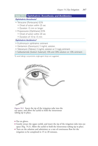 Chapter 74 | Eye Irrigation 347
● Put on gloves.
● Gently retract the upper eyelid, and insert the tip of the irrigation tube into eye
space (Fig. 74.1). Allow the eyelid to hold the intravenous tubing tip in place.
● Turn on the solution and administer at a rate of continuous flow for the
irrigation to be completed in 15 to 20 minutes.
Table 74∙1 Ophthalmic Anesthesia and Antibiotics
Ophthalmic Anesthesia*
• Tetracaine (Pontocaine) 0.5%
• Onset of action within 25 sec
• Duration 15 min or longer
• Proparacaine (Ophthaine) 0.5%
• Onset of action within 20 sec
• Duration of 10 to 15 min
Ophthalmic Antibiotics*
• Erythromycin ophthalmic ointment
• Gentamicin (Garamycin) 3 mg/mL solution
• Tobramycin (Tobrex) 3 mg/mL solution or 3 mg/g ointment
• Sulfacetamide (Sodium Sulamyd) 10% and 30% solution or 10% ointment
To avoid allergic conjunctivitis, single-agent drops are suggested.
Figure 74.1 Insert the tip of the irrigation tube into the
eye space, and allow the eyelid to hold the intravenous
tubing tip in place.
4206_Chapter 4_0313-0402.indd 3474206_Chapter 4_0313-0402.indd 347 12/24/2014 2:01:52 PM12/24/2014 2:01:52 PM
Process CyanProcess CyanProcess MagentaProcess MagentaProcess YellowProcess YellowProcess BlackProcess Black
 