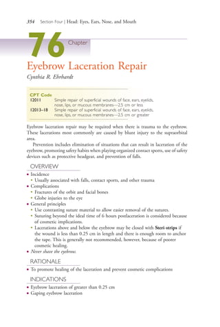 354 Section Four | Head: Eyes, Ears, Nose, and Mouth
76Chapter
Eyebrow Laceration Repair
Cynthia R. Ehrhardt
CPT Code
12011 Simple repair of superficial wounds of face, ears, eyelids,
nose, lips, or mucous membranes—2.5 cm or less
12013–18 Simple repair of superficial wounds of face, ears, eyelids,
nose, lips, or mucous membranes—2.5 cm or greater
Eyebrow laceration repair may be required when there is trauma to the eyebrow.
These lacerations most commonly are caused by blunt injury to the supraorbital
area.
Prevention includes elimination of situations that can result in laceration of the
eyebrow, promoting safety habits when playing organized contact sports, use of safety
devices such as protective headgear, and prevention of falls.
OVERVIEW
● Incidence
●
Usually associated with falls, contact sports, and other trauma
● Complications
●
Fractures of the orbit and facial bones
●
Globe injuries to the eye
● General principles
●
Use contrasting suture material to allow easier removal of the sutures.
●
Suturing beyond the ideal time of 6 hours postlaceration is considered because
of cosmetic implications.
●
Lacerations above and below the eyebrow may be closed with Steri-strips if
the wound is less than 0.25 cm in length and there is enough room to anchor
the tape. This is generally not recommended, however, because of poorer
cosmetic healing.
● Never shave the eyebrow.
RATIONALE
● To promote healing of the laceration and prevent cosmetic complications
INDICATIONS
● Eyebrow laceration of greater than 0.25 cm
● Gaping eyebrow laceration
4206_Chapter 4_0313-0402.indd 3544206_Chapter 4_0313-0402.indd 354 12/24/2014 2:01:53 PM12/24/2014 2:01:53 PM
Process CyanProcess CyanProcess MagentaProcess MagentaProcess YellowProcess YellowProcess BlackProcess Black
 