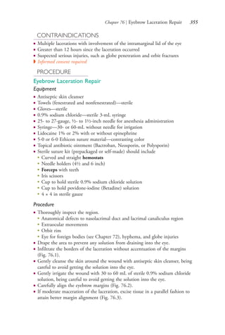 Chapter 76 | Eyebrow Laceration Repair 355
CONTRAINDICATIONS
● Multiple lacerations with involvement of the intramarginal lid of the eye
● Greater than 12 hours since the laceration occurred
● Suspected serious injuries, such as globe penetration and orbit fractures
◗ Informed consent required
PROCEDURE
Eyebrow Laceration Repair
Equipment
● Antiseptic skin cleanser
● Towels (fenestrated and nonfenestrated)—sterile
● Gloves—sterile
● 0.9% sodium chloride—sterile 3-mL syringe
● 25- to 27-gauge, ½- to 1½-inch needle for anesthesia administration
● Syringe—30- or 60-mL without needle for irrigation
● Lidocaine 1% or 2% with or without epinephrine
● 5-0 or 6-0 Ethicon suture material—contrasting color
● Topical antibiotic ointment (Bactroban, Neosporin, or Polysporin)
● Sterile suture kit (prepackaged or self-made) should include
●
Curved and straight hemostats
●
Needle holders (4½ and 6 inch)
●
Forceps with teeth
●
Iris scissors
●
Cup to hold sterile 0.9% sodium chloride solution
●
Cup to hold povidone-iodine (Betadine) solution
●
4 × 4 in sterile gauze
Procedure
● Thoroughly inspect the region.
●
Anatomical defects to nasolacrimal duct and lacrimal canaliculus region
●
Extraocular movements
●
Orbit rim
●
Eye for foreign bodies (see Chapter 72), hyphema, and globe injuries
● Drape the area to prevent any solution from draining into the eye.
● Infiltrate the borders of the laceration without accentuation of the margins
(Fig. 76.1).
● Gently cleanse the skin around the wound with antiseptic skin cleanser, being
careful to avoid getting the solution into the eye.
● Gently irrigate the wound with 30 to 60 mL of sterile 0.9% sodium chloride
solution, being careful to avoid getting the solution into the eye.
● Carefully align the eyebrow margins (Fig. 76.2).
● If moderate maceration of the laceration, excise tissue in a parallel fashion to
attain better margin alignment (Fig. 76.3).
4206_Chapter 4_0313-0402.indd 3554206_Chapter 4_0313-0402.indd 355 12/24/2014 2:01:53 PM12/24/2014 2:01:53 PM
Process CyanProcess CyanProcess MagentaProcess MagentaProcess YellowProcess YellowProcess BlackProcess Black
 