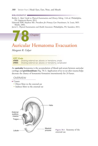 360 Section Four | Head: Eyes, Ears, Nose, and Mouth
BIBLIOGRAPHY
Bickley L. Bates’ Guide to Physical Examination and History-Taking. 11th ed. Philadelphia,
PA: Lippincott-Raven; 2012.
Edmunds MW, Mayhew MS. Procedures for Primary Care Practitioners. St. Louis, MO:
Mosby; 2002.
Jarvis C. Physical Examination and Health Assessment. Philadelphia, PA: Saunders; 2011.
78Chapter
Auricular Hematoma Evacuation
Margaret R. Colyar
CPT Code
69000 Draining external ear; abscess or hematoma, simple
69005 Draining external ear; abscess or hematoma, complicated
An auricular hematoma is the accumulation of blood and serum between auricular
cartilage and perichondrium (Fig. 78.1). Application of ice to ear after trauma helps
decrease the chance of hematoma formation intermittently for 24 hours.
OVERVIEW
● Causes
●
Direct blow to the external ear
●
Indirect blow to the external ear
Figure 78.1 Anatomy of the
external ear.
Helix
Mastoid
processLobule
External
auditory
meatus
Tragus
4206_Chapter 4_0313-0402.indd 3604206_Chapter 4_0313-0402.indd 360 12/24/2014 2:01:54 PM12/24/2014 2:01:54 PM
Process CyanProcess CyanProcess MagentaProcess MagentaProcess YellowProcess YellowProcess BlackProcess Black
 