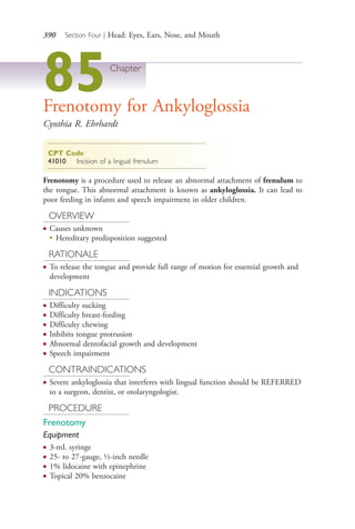 390 Section Four | Head: Eyes, Ears, Nose, and Mouth
85Chapter
Frenotomy for Ankyloglossia
Cynthia R. Ehrhardt
CPT Code
41010 Incision of a lingual frenulum
Frenotomy is a procedure used to release an abnormal attachment of frenulum to
the tongue. This abnormal attachment is known as ankyloglossia. It can lead to
poor feeding in infants and speech impairment in older children.
OVERVIEW
● Causes unknown
●
Hereditary predisposition suggested
RATIONALE
● To release the tongue and provide full range of motion for essential growth and
development
INDICATIONS
● Difficulty sucking
● Difficulty breast-feeding
● Difficulty chewing
● Inhibits tongue protrusion
● Abnormal dentofacial growth and development
● Speech impairment
CONTRAINDICATIONS
● Severe ankyloglossia that interferes with lingual function should be REFERRED
to a surgeon, dentist, or otolaryngologist.
PROCEDURE
Frenotomy
Equipment
● 3-mL syringe
● 25- to 27-gauge, ½-inch needle
● 1% lidocaine with epinephrine
● Topical 20% benzocaine
4206_Chapter 4_0313-0402.indd 3904206_Chapter 4_0313-0402.indd 390 12/24/2014 2:01:55 PM12/24/2014 2:01:55 PM
Process CyanProcess CyanProcess MagentaProcess MagentaProcess YellowProcess YellowProcess BlackProcess Black
 