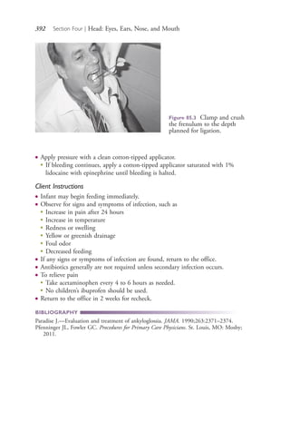 392 Section Four | Head: Eyes, Ears, Nose, and Mouth
● Apply pressure with a clean cotton-tipped applicator.
●
If bleeding continues, apply a cotton-tipped applicator saturated with 1%
lidocaine with epinephrine until bleeding is halted.
Client Instructions
● Infant may begin feeding immediately.
● Observe for signs and symptoms of infection, such as
●
Increase in pain after 24 hours
●
Increase in temperature
●
Redness or swelling
●
Yellow or greenish drainage
●
Foul odor
●
Decreased feeding
● If any signs or symptoms of infection are found, return to the office.
● Antibiotics generally are not required unless secondary infection occurs.
● To relieve pain
●
Take acetaminophen every 4 to 6 hours as needed.
●
No children’s ibuprofen should be used.
● Return to the office in 2 weeks for recheck.
BIBLIOGRAPHY
Paradise J.—Evaluation and treatment of ankyloglossia. JAMA. 1990;263:2371–2374.
Pfenninger JL, Fowler GC. Procedures for Primary Care Physicians. St. Louis, MO: Mosby;
2011.
Figure 85.3 Clamp and crush
the frenulum to the depth
planned for ligation.
4206_Chapter 4_0313-0402.indd 3924206_Chapter 4_0313-0402.indd 392 12/24/2014 2:01:55 PM12/24/2014 2:01:55 PM
Process CyanProcess CyanProcess MagentaProcess MagentaProcess YellowProcess YellowProcess BlackProcess Black
 