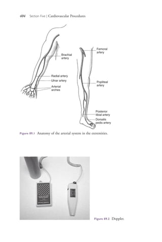 404 Section Five | Cardiovascular Procedures
Brachial
artery
Radial artery
Ulnar artery
Arterial
arches
Femoral
artery
Popliteal
artery
Posterior
tibial artery
Dorsalis
pedis artery
Figure 89.1 Anatomy of the arterial system in the extremities.
Figure 89.2 Doppler.
4206_Chapter 5_.indd 4044206_Chapter 5_.indd 404 12/24/2014 2:30:59 PM12/24/2014 2:30:59 PM
Process CyanProcess CyanProcess MagentaProcess MagentaProcess YellowProcess YellowProcess BlackProcess Black
 